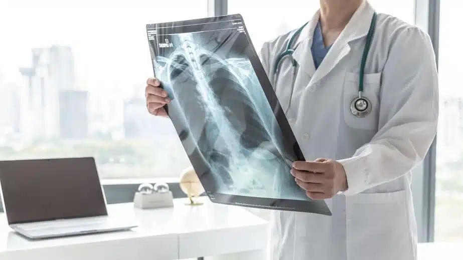 A doctor looking at an x-ray