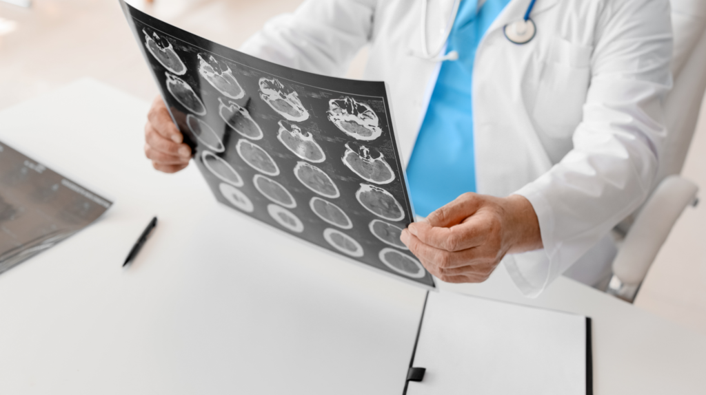 Tampa Brain Injury Lawyer | Experienced TBI Attorneys