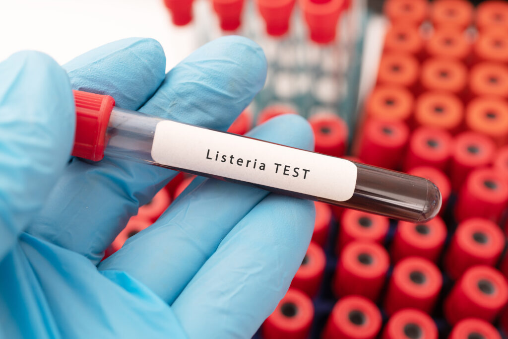 a hand holding a test tube for a listeria outbreak test